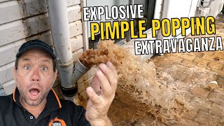 Blocked Drain 478 Explosive Pimple Popping Extravaganza