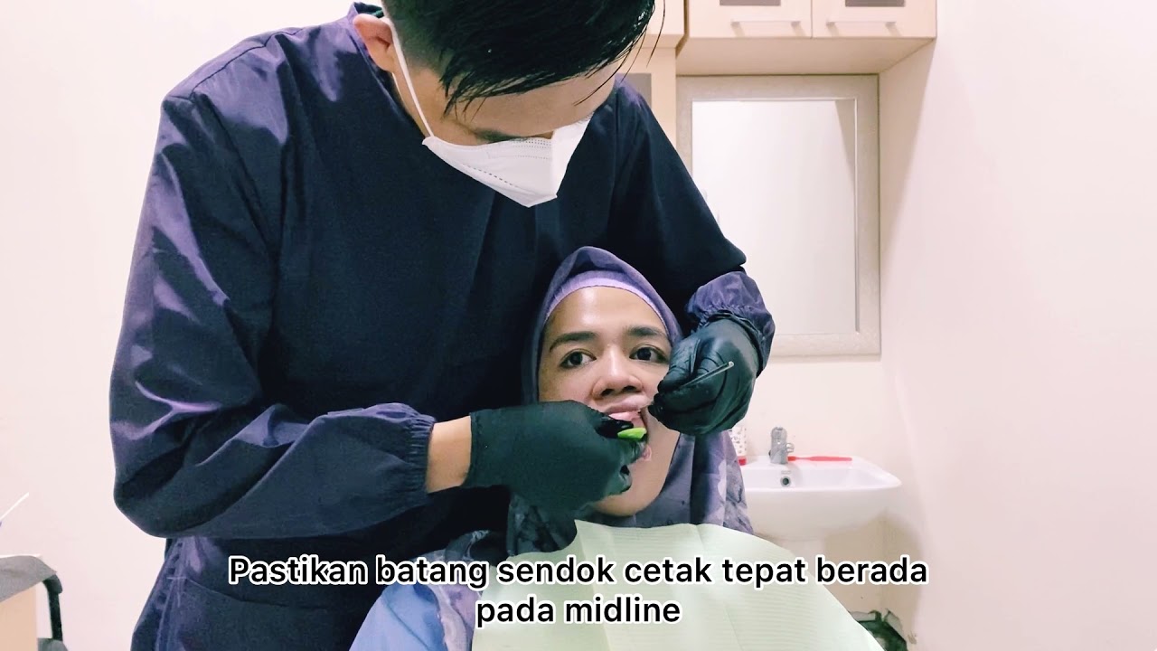 Simulasi Mencetak Anatomis Gigi Tiruan Sebagian Lepasan (GTSL)