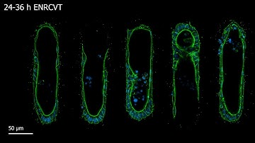 Movie S3: Tissue geometry controls cell fate choices and patterning