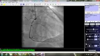 Angiogram Report