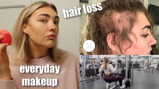 HEALTHY WEEKEND VLOG!! MY EVERYDAY MAKEUP ROUTINE, WHERE I&#39;VE BEEN, LOSING MY HAIR TO PSORIASIS ):