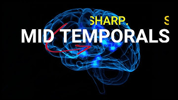 B.E.T.S. (SSS)  Normal Variant EEG - Studying for Abret Board Exam