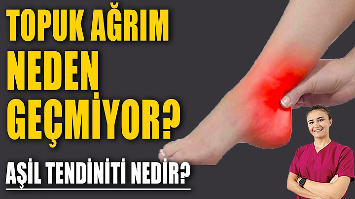 AŞİL TENDİNİTİ NEDİR? TEDAVİSİ? #aktifizyo #kulunçağrısı #fiziktedavi #topuk