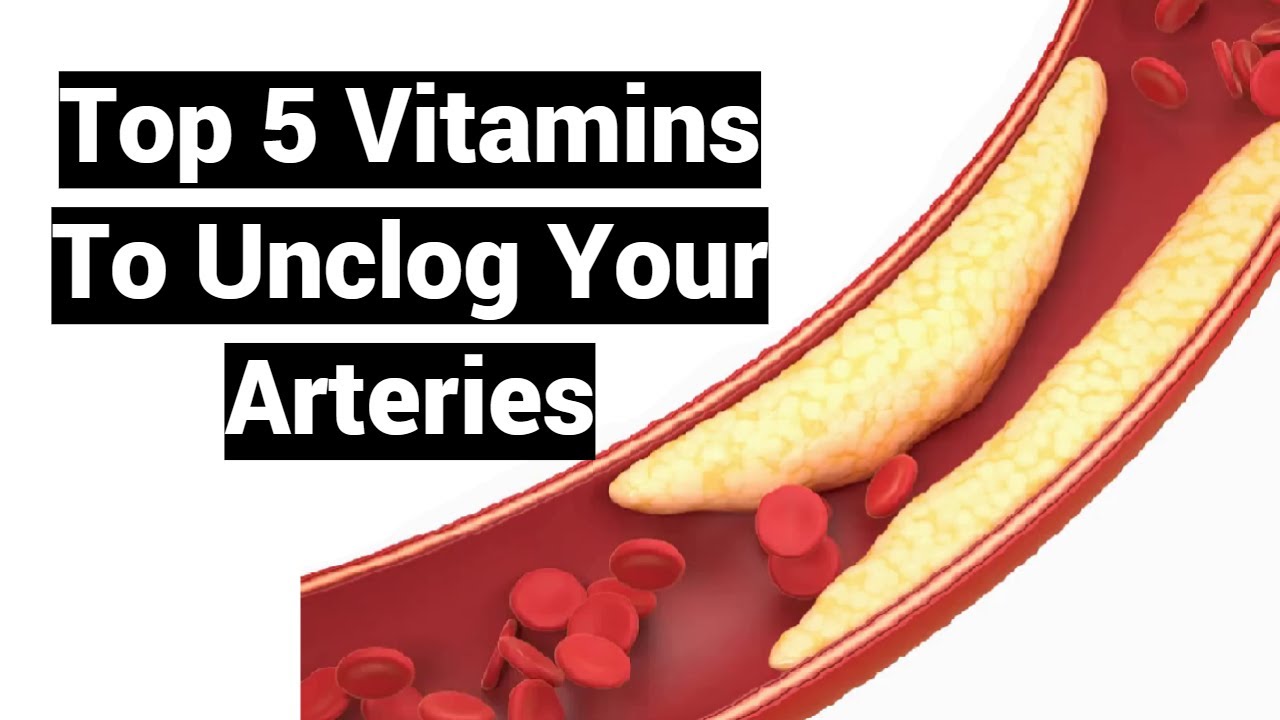 Top 5 Vitamins To Unclog Your Arteries YouTube