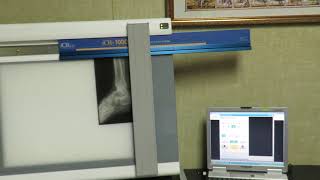 iCRco iCR-1000SL LARGE FORMAT X-RAY Film Digitizer 4sale on ebay scanner