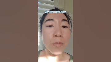 I took Collagen for 3 months and this is what happened