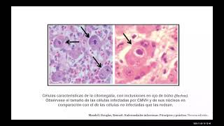 Clase 67 - Infecciones virales sistemicas