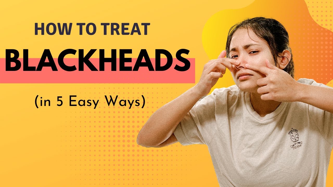 How to Get Rid of Blackheads on Nose | Tips + Products