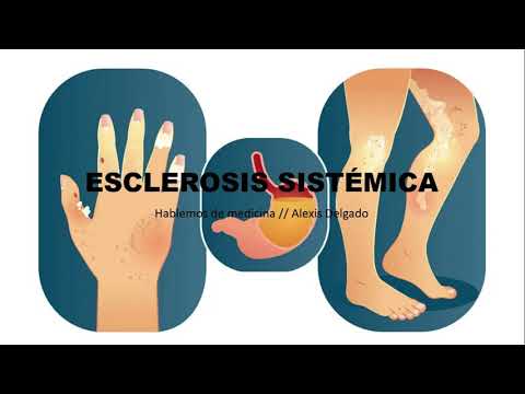 Vídeo: Esclerodermia Sistémica: Diagnóstico, Tratamiento, Pronóstico