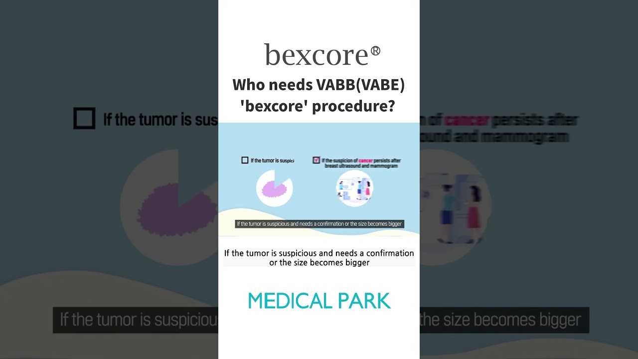 [Bexcore] Vacuum Assisted Breast Biopsy System - Who is it for?