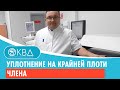 😐 Уплотнение на крайней плоти члена. Клинический случай №309