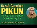 Dr aisah dahlan cht  penyebab terjadinya pikun  cara mengatasi pikun  dr aisyah dahlan terbaru