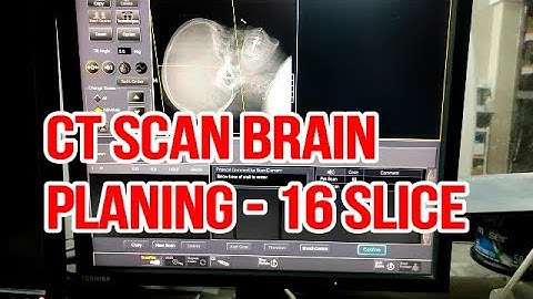 CAT scan Protocol, Positioning and Planning | Live Demo.