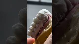 second buildap #dentist #dentalprocedure #zirconia #design