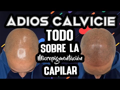 ¿Como eliminar la