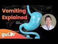 What happens during vomiting  the gutdr explains 3d gut animation