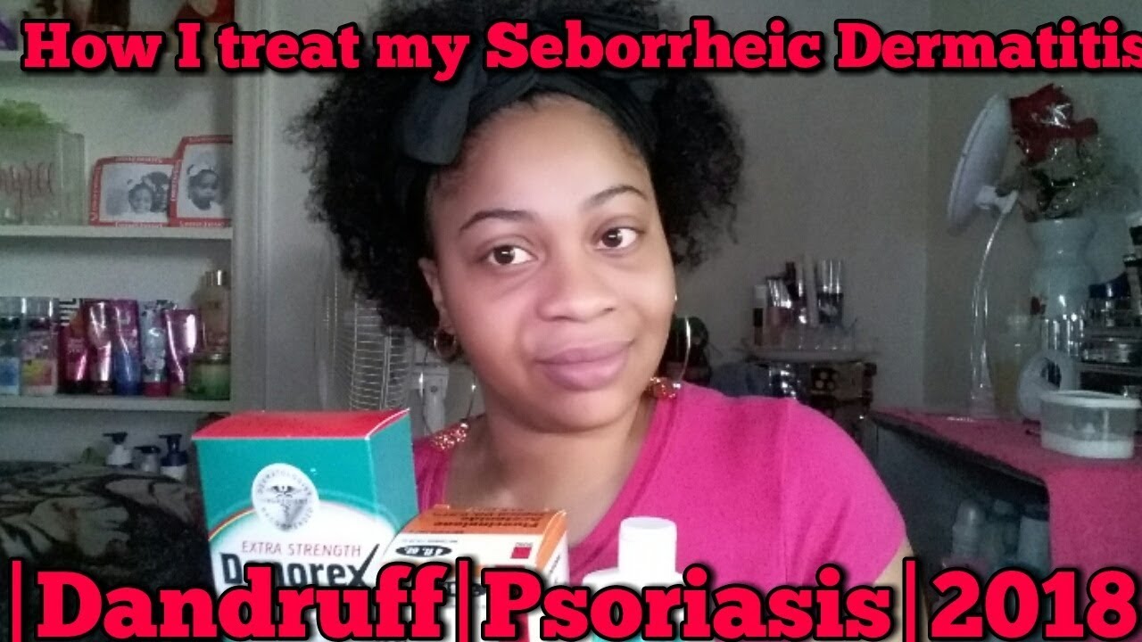How I treat my Seborrheic Dermatitis |Dandruff|Psoriasis|2018 - YouTube