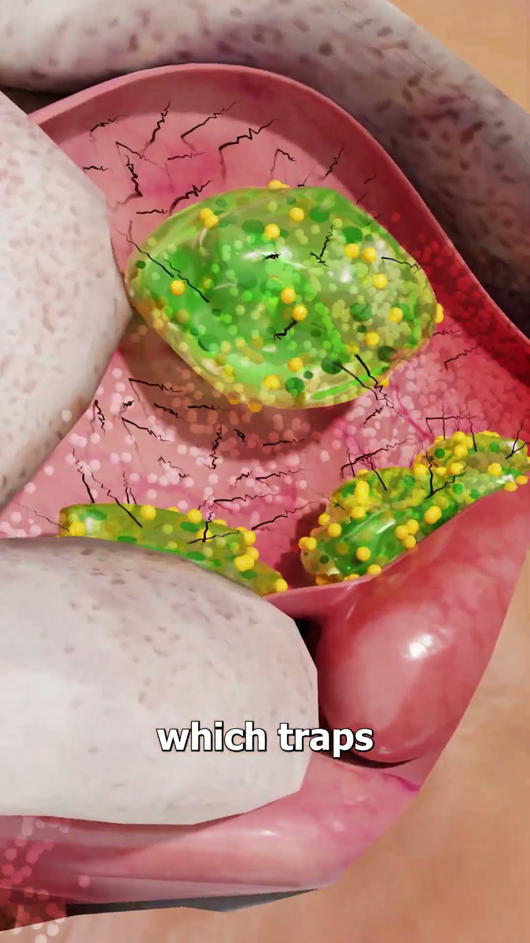 Why You Shouldn’t Eat Your Boogers ?