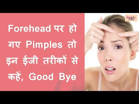 Check out the best ways to get rid of pimples on forehead in one day. teenager forehead. mathe par