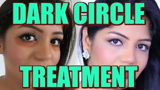 How To Treat dark Under Eye Circles At home| SuperPrincessjo