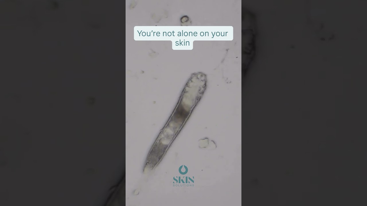 Best Skincare for Wrinkle-Free Skin – Seriskin Review | Link in Comments