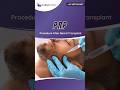 Best PRP Therapy for Beard Transplant in Surat, Adajan | Dr. Rushin B. Thakor at Callisto Clinic.
