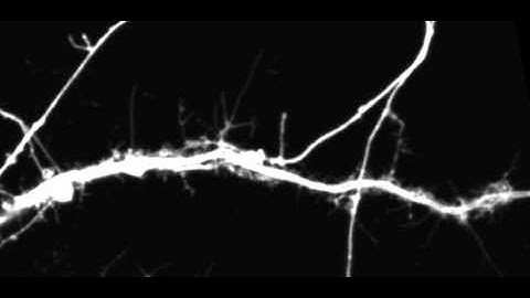 Spine dynamics of control neurons