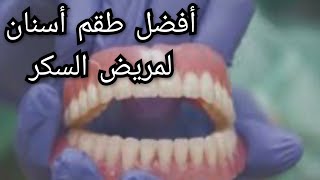 أفضل طقم أسنان لمريض السكر ( أفضل تركيبة أسنان متحركة جزئية أو كاملة لمريض السكري ) dentier