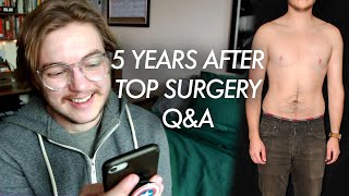 What If You Don't Like Your Results? | 5 Years Post-Top Surgery Q&A