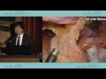 Современная хирургия рака желудка в Японии