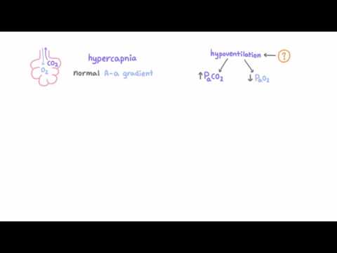 Video: Kas yra neobstrukcinė alveolių hipoventiliacija?