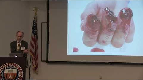 2013 Biomedical Symposium Allan mp4