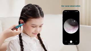 Bebird EarSight Ultra Unboxing & Step-by-Step User Guide 📦✨