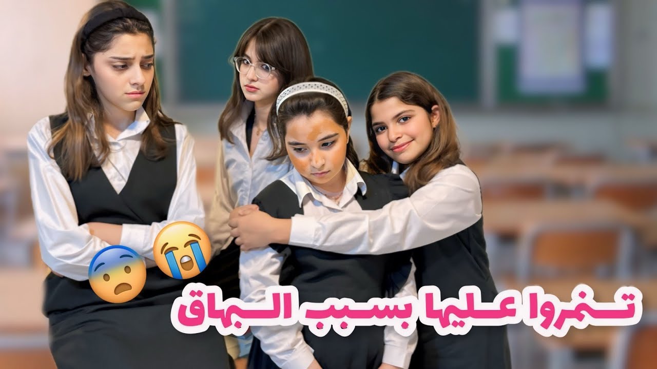 تنمروا عليها بسبب البهاق !! 😨😭