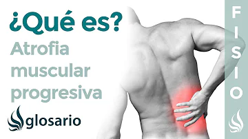 ¿Cómo empieza la atrofia muscular?