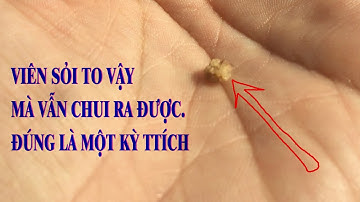 Thật không ngờ trị Sỏi Thận lại đơn giản thế này.nay về sau không còn sợ mổ hay tán sỏi nữa.