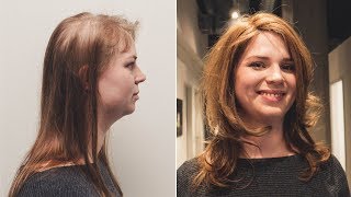 Transformation zum vollen Haar | Tritec-Hair Integration | Hairsystems Heydecke