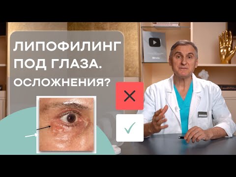 ЛИПОФИЛИНГ ПОД ГЛАЗА 👁 УБРАТЬ СИНЯКИ ПОД ГЛАЗАМИ  👁 ЕСТЬ ЛИ ОСЛОЖНЕНИЯ?