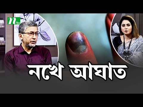 ভিডিও: পায়ের নখ পড়ে গেলে কি ব্যথা হয়?