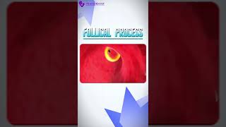 गर्भधारण के लिए सबसे महत्वपूर्ण चरण #IVF #pregnancy