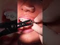 LEPAS BEHEL SETELAH PEMAKAIAN SELAMA 4 TAHUN #behel #behelgigi #kawatgigi #braces #metalbraces