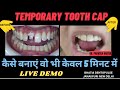 LIV DEMO-TEMPORARY TOOTH CAP कैसे बनाएं वो भी केवल 5 मिनट में #temporarycrown