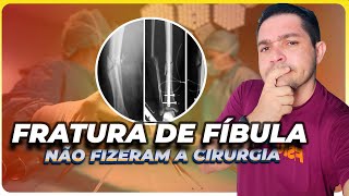 Fratura De Tíbia E Fíbula A Fíbula Sem Cirurgia E Agora?