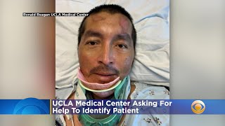 UCLA Medical Center Asking For Help To Identify Patient