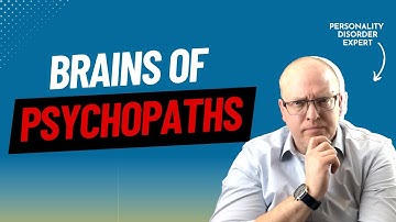 Psychologist Explains 4 Ways Brains of Psychopaths Are Different