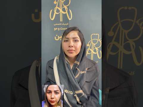 بلفاروپلاستی پلک بالا و لیفت سانترال لب در کلینیک ارتین    جراحی زیبایی