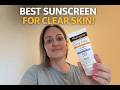 No Breakout Sunscreen That Actually Works