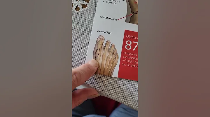 foot surgery