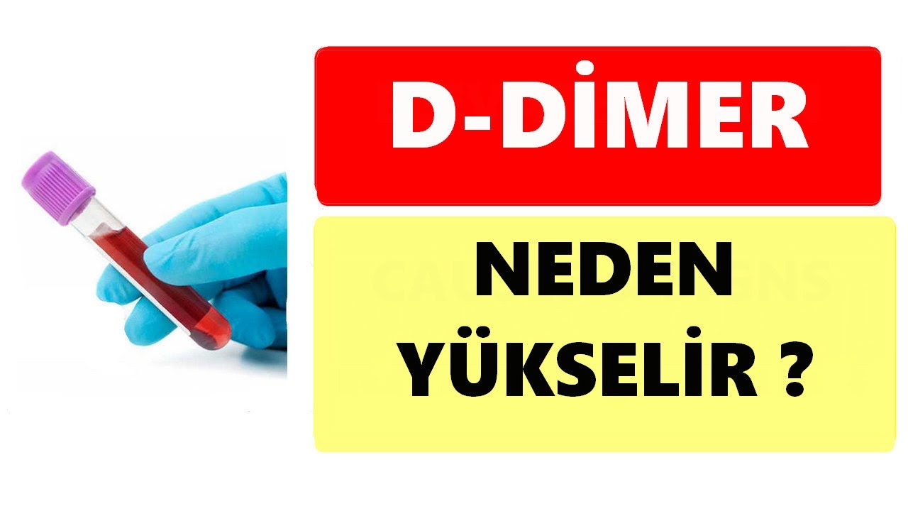 D-DİMER YÜKSEK ÇIKTI, BU NE DEMEK ? - YouTube