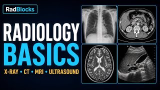     Introduction to Radiology for Clinical Rotations | Medical Students screenshot 1